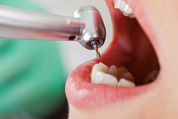 Best Emergency Pediatric Dental Care in Milford, NE